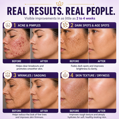 Elivessa™ Biotin 10-in-1 Skin Restoration Cream