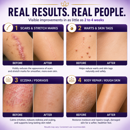 Elivessa™ Biotin 10-in-1 Skin Restoration Cream