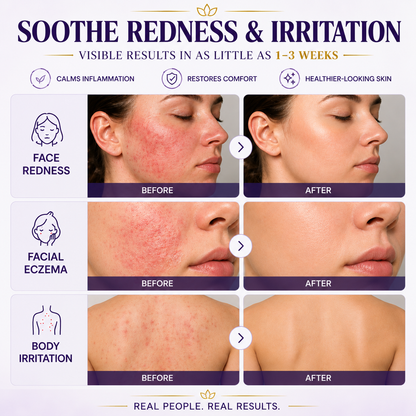 Elivessa™ Biotin 10-in-1 Skin Restoration Cream